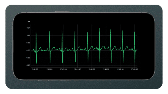 High Quality Continuous ECG