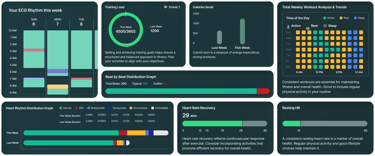 Weekly Cardiac Rhythm Report Dashboard