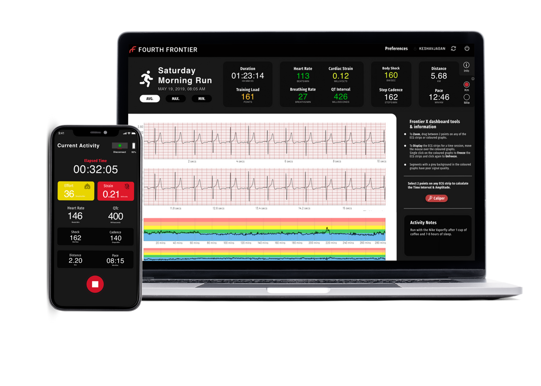 Frontier Heart Program (one-time only)