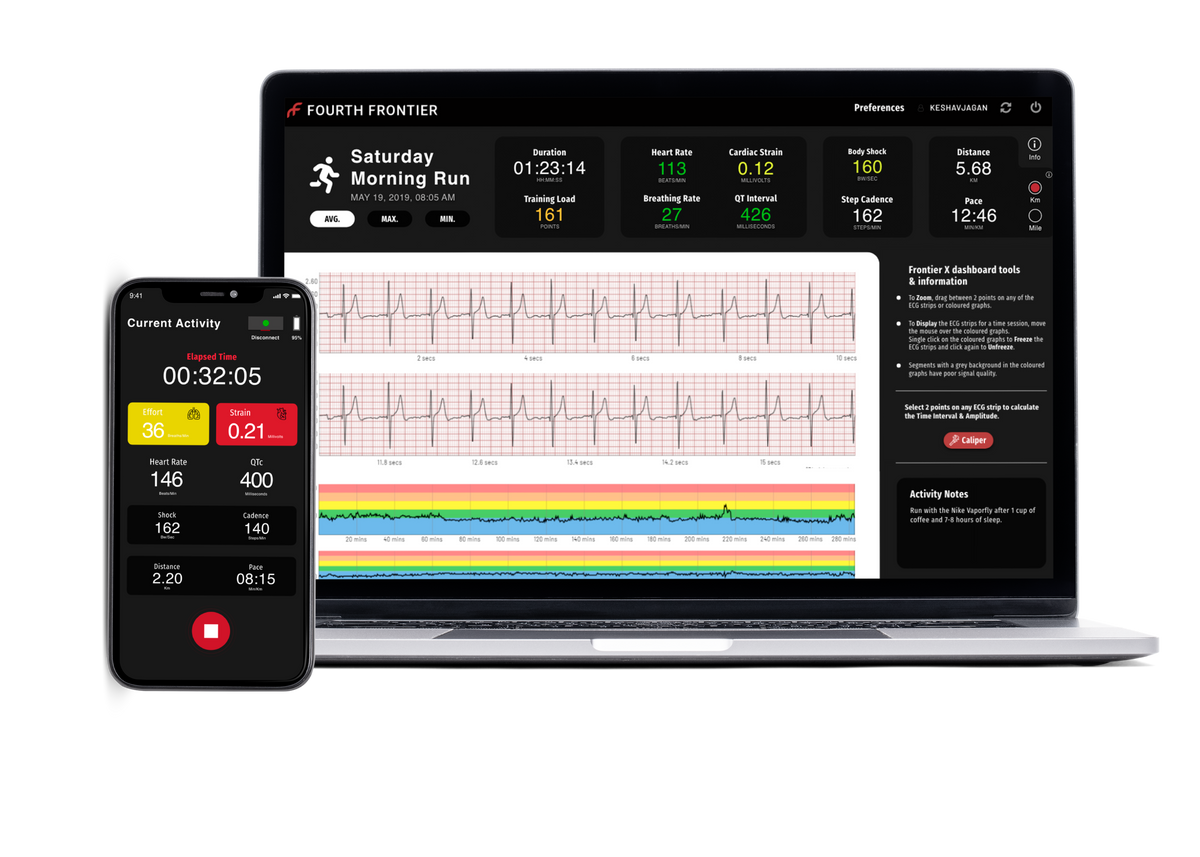 Frontier Heart Program (one-time only)